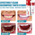 SP4 Toothpaste Ultra Whitening Toothpaste SP-4 Probiotics Whitening Toothpaste by Yayashi | Hismile V34 - V34 Colour Corrector -. 
