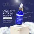 Anti- Acne Clearing Serum | Serum for Acne | Pimples | Clear Skin | Blackheads | Salicylic Acid | 30ml | MZ SKINCARE. 