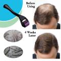 Derma Roller 540 Titanium Micro Needles for Beard Growth and Hair Loss Treatment 0.5mm. 
