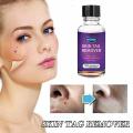 10ml/20ml/30ml/50ml Skin Tag Remover For Common And Plantar Warts Remove. 