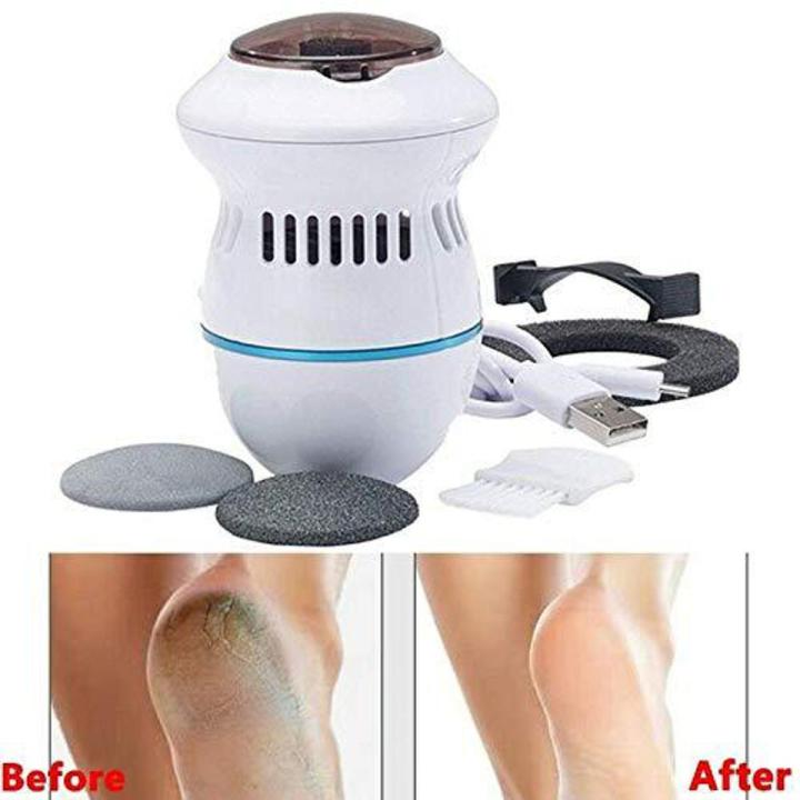 Pedi Vac Rechargeable Electronic by PedEgg Foot File and Callus Remover Kit with Built-In Vacuum