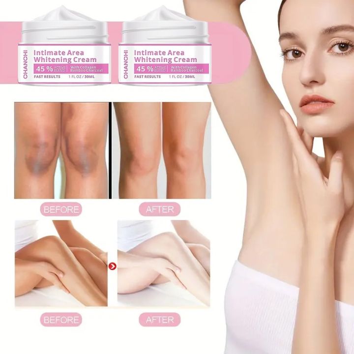 Skin%20Brightening%20Cream%20for%20Men%20&%20Women%20%20Dark%20Spot%20Corrector%20for%20Even%20Skin%20Tone%20&%20%20%20Hydrating%20&%20Smoothing%20Formula%20for%20Face,%20%20Inner%20Thighs%20&%20Body%20%E2%80%93%20Daily%20Use%20Moisturizing%20Cream%2030ML%20-%20Image%204