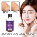 10ml/20ml/30ml/50ml Skin Tag Remover For Common And Plantar Warts Remove. 
