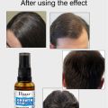 Disaar Vegan Natural Gnseng Root Promotes Hair Growth Strengthen Anti-Hair Loss Spray 30ml  DS4002. 