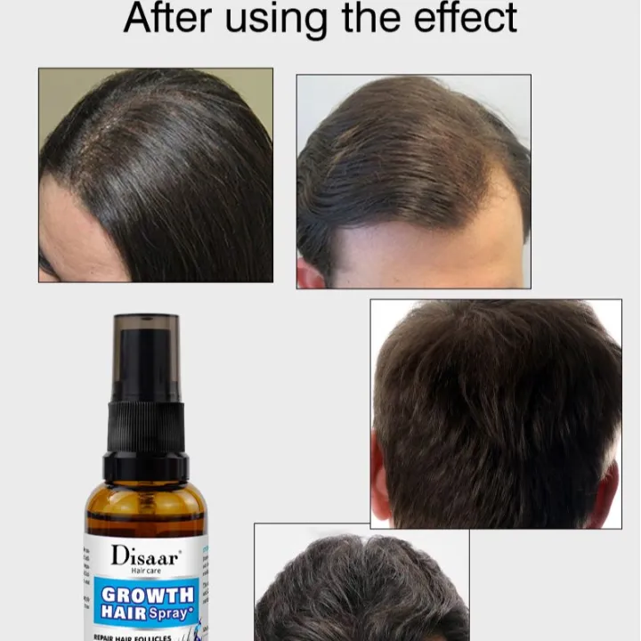 Disaar%20Vegan%20Natural%20Gnseng%20Root%20Promotes%20Hair%20Growth%20Strengthen%20Anti-Hair%20Loss%20Spray%2030ml%20%20DS4002%20-%20Image%204