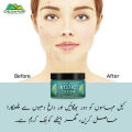 Kojic Cream – Affordable and quality body lotion cream, prevents hyperpigmentation, fades dark spots, treats melasma, minimizes discoloration – 100% pure organic. 