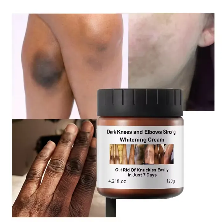 MOOYAM%20Dark%20Knuckles%20Cleaning%20Cream,%20Private%20Part%20Whitening%20Cream%20,%20Black%20Joints%20Brightening%20Solution,%20%20Dark%20Spot%20remover,%20Intimate%20areas%20whitening%20cream%20-%20120g%20-%20Image%203