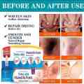 Skin Whitening Cream For All Body Fast-Acting Cream for Dark Knuckles with Kojic Acid - Say Goodbye to Discoloration On Body. 