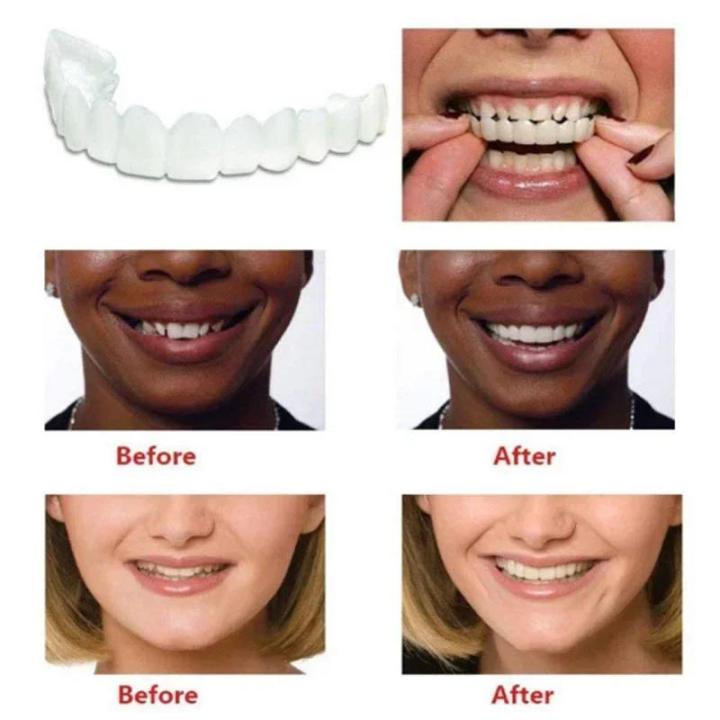 Dentures%20Full%20Set%20Natural%20Perfect%20Fit%20Teeth%20Whitening%20Snap%20On%20Silicone%20Denture%20Instant%20Smile%20Veneers%20Teeth%20Dentadura%20Beauty%20Tool%20-%20Image%204