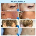 Dr Pen H3,Dr.Pen Hydra Pen H3 Newest Microneedle Derma pen H3. 