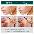 Acne Warts Removal Patch Skin Cleaning Tags Pimple Treatments Corn Plaster Acne Warts Invisible Healing Antibacterial Stickers. 