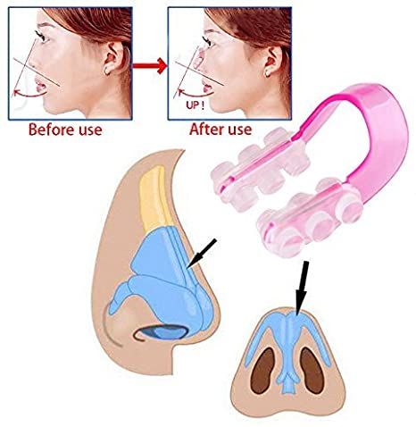 Beauty%20Hot%20Selling%20Nose%20Clip/Nose%20Shaper/Nose%20Reshaping%20Clip%20-%20Image%203