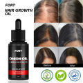 FORT FORT Onion Hair Oil – Hair Growth Oil for Stronger, Healthier Hair | Nourishing Hair Oil Bottle for Haircare & Enhanced Growth. 