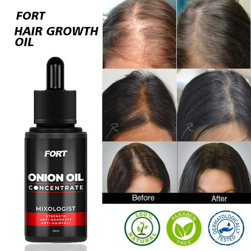 FORT FORT Onion Hair Oil – Hair Growth Oil for Stronger, Healthier Hair | Nourishing Hair Oil Bottle for Haircare & Enhanced Growth