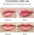 Hyaluronic Acid Anti-Wrinkle Lip Pen 2 in 1 Hyaluronic Acid Pen Meso View Injection Gun (For Lip Filler Injection)(1 Pieces of 0.3Ml Ampoules). 