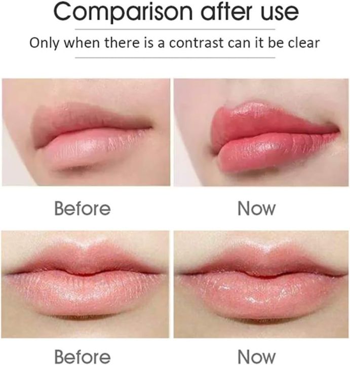 Hyaluronic%20Acid%20Anti-Wrinkle%20Lip%20Pen%202%20in%201%20Hyaluronic%20Acid%20Pen%20Meso%20View%20Injection%20Gun%20(For%20Lip%20Filler%20Injection)(1%20Pieces%20of%200.3Ml%20Ampoules)%20-%20Image%203