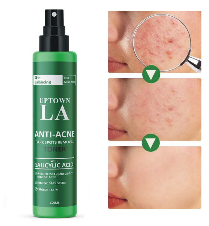 Uptown%20LA%20Women's%20Anti-Acne%20Face%20Toner%20with%202%25%20Salicylic%20Acid%20-%20100m%20-%20Image%202