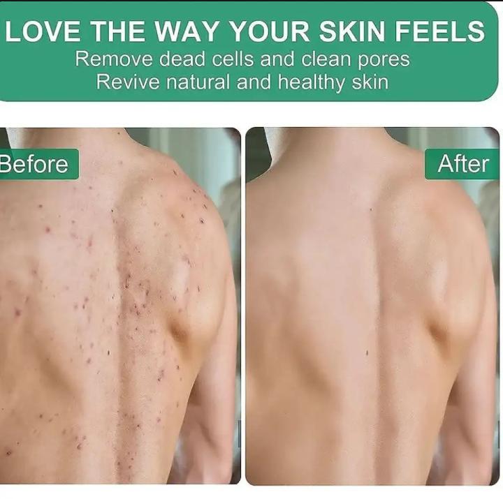 UN%20Enterprises%20Premium%20Body%20Exfoliating%20Glove%20%7C%20Pore%20Cleansing%20%7C%20Body%20Scrub%20Mitt%20for%20Dead%20Skin%20Removal%20%7C%20Korean%20&%20Moroccan%20Bath%20Exfoliating%20Mitt%20%7C%20Dead%20Skin%20Remover%20%7C%20Smooth%20Skin%20Enhancement%20%7C%20Anti-Aging%20%7C%20Spa-Style%20Massage%20Accessory%20-%20Image%206