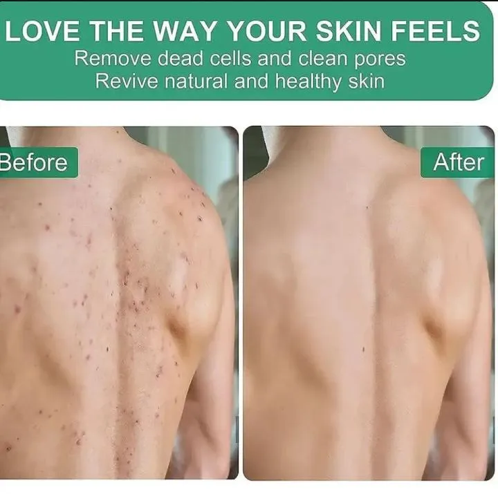 1pcs%20High%20Quality%20Exfoliating%20Gloves%20,%20Dead%20Skin%20Remover%20Sponge%20Deep%20Exfoliator%20for%20smoothing%20,%20Body%20scrubber%20for%20bathing%20and%20massage%20-%20Image%204