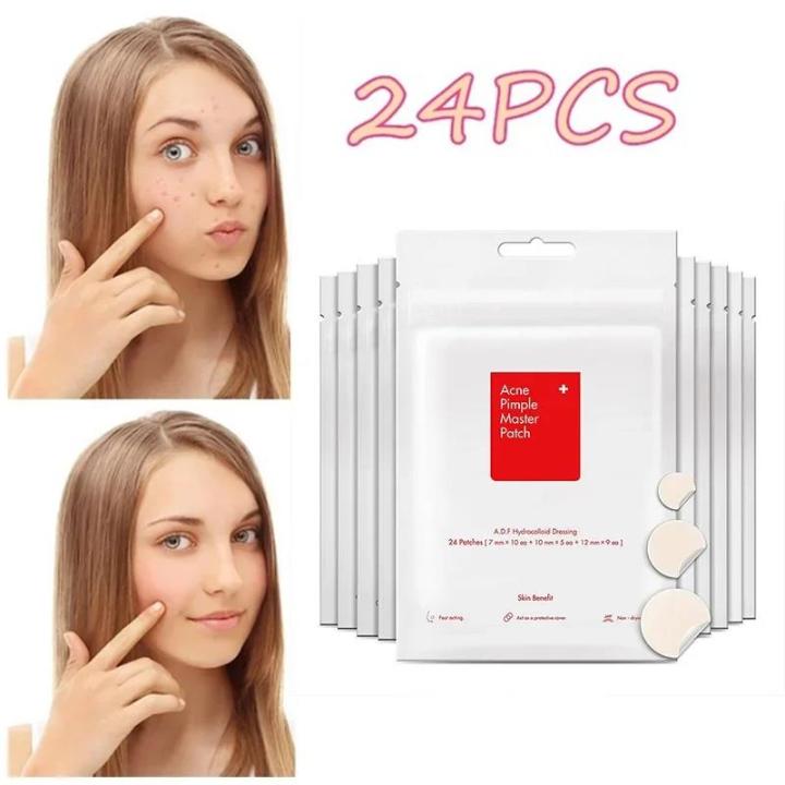 24pcs%20Face%20Acne%20Pimple%20Spot%20Facial%20Skin%20Care%20Blackhead%20Removal%20Freckle%20Patches%20Scar%20Care%20Treatment%20Stickers%20Acne%20Mask%20Beauty%20-%20Image%203