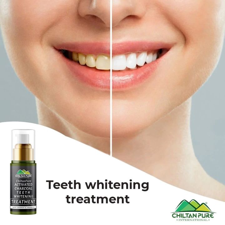 Activated%20Charcoal%20Teeth%20Whitening%20Treatment%20%E2%80%93%20Whitens%20Teeth%20Naturally,%20Kills%20Cavity%20causing%20Bacteria%20&%20Eliminates%20Bad%20Breath%20-%20Image%204