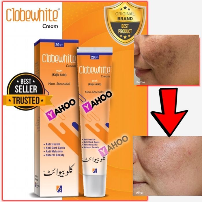 Kojic%20Acid%20Cream%20For%20Pigmentation%20For%20Face%20Whitening%20Scar%20Removal%20Dark%20Spots%20&%20Hyperpigmentation%20Best%20For%20All%20Skin%20Types%20You%20will%20Like%20the%20Results%20-%20%F0%9F%87%B0%E2%80%8C%F0%9F%87%B4%E2%80%8C%F0%9F%87%AF%E2%80%8C%F0%9F%87%AE%E2%80%8C%F0%9F%87%A8%E2%80%8C%20%F0%9F%87%A6%E2%80%8C%F0%9F%87%A8%E2%80%8C%F0%9F%87%AE%E2%80%8C%F0%9F%87%A9%E2%80%8C%20%F0%9F%87%A8%E2%80%8C%F0%9F%87%B7%E2%80%8C%F0%9F%87%AA%E2%80%8C%F0%9F%87%A6%E2%80%8C%F0%9F%87%B2%E2%80%8C%20-%20Image%203