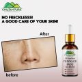 Freckles Fade Serum – Hydrates Skin, Fade Freckles, Reduce Blemishes & Lighten Pigmentation. 