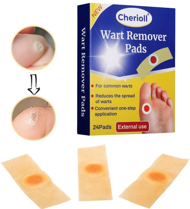 Wart%20Remover,%20Corn%20Cap%20Wart%20Removal%20Plasters%20Pad,%20Foot%20Corn%20Removal%20Plaster%20with%20Hole,%20Feet%20Callus%20Remove,%20Soften%20Skin%20Cutin%20Sticker%20Cure%20Toe%20Protector,%20Relief%20Pain%20Removal%20Warts%20Plaster%2015%20Pcs%20-%20Image%202
