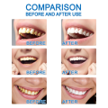 Eelhoe Tooth Whitening Product Powder Clean Oral Hygiene Whiten Teeth Remove Plaque Stains Fresh Breath Oral Hygiene Dental Tool. 