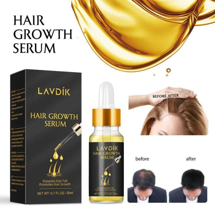 Lavdik anti loss hair serum essential oil liquid ginger fast hair growth damaged preventing hair repair growing Women Men 20ml