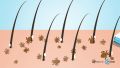 8 Pieces Double Sided Fine Tooth Hair Comb Head Lice Hair Comb For Kids & Pets. 