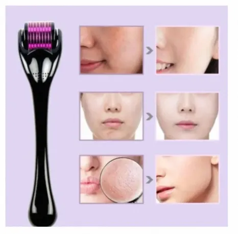 High%20Quality%20Derma%20Roller%200.5%20mm%20Hair%20&%20Skin%20System%20Shirnk%20Pores%20wrinkles%20freckle%20dark%20circle%20improve%20dull%20skin%20tone%20-%20Image%202