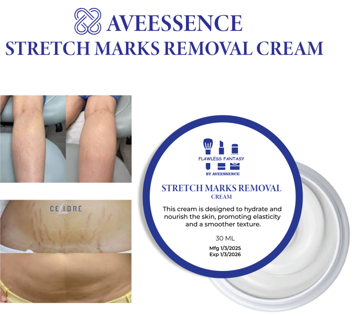 Aveessence Stretch mark removal cream After pregnancy for stretch marks Stretch mark treatment How to remove stretch marks fast Top stretch mark creams for 2025 Natural stretch mark removal Stretch mark cream for pregnancy Effective stretch mark