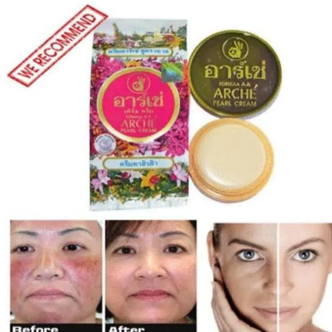 Beauty%20Cream%20Arche%20Pearl%20Beauty%20Cream%20%E2%80%93%20Whitening%20&%20Moisturizing%20Cream%20%7C%20Removes%20Acne,%20Freckles,%20Dark%20Spots%20&%20Wrinkles%20-%20Image%202