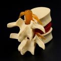 Lumbar Vertebrae Model Anatomical Spine Lumbar Disc Herniation Anatomy Teaching Tool Lumbar Vertebrae Model. 