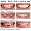 "Snap-On Silicone Fake Braces | Stylish & Comfortable Imitation Braces for a Trendy Look – Premium Quality | Fashionable Fake Teeth Braces | Realistic Cosmetic Braces for a Confident Smile. 