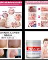 Sudocrem Antiseptic Healing Cream For Nappy Rash, Eczema, Burns, Wounds and more. 