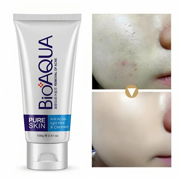 BIOAQUA%20Facial%20Cleanser%20Acne%20Treatment%20Blackhead%20Remover%20Oil%20Whitening%20Shrink%20Pores%20Face%20Wash%20100g%20-%20Image%202