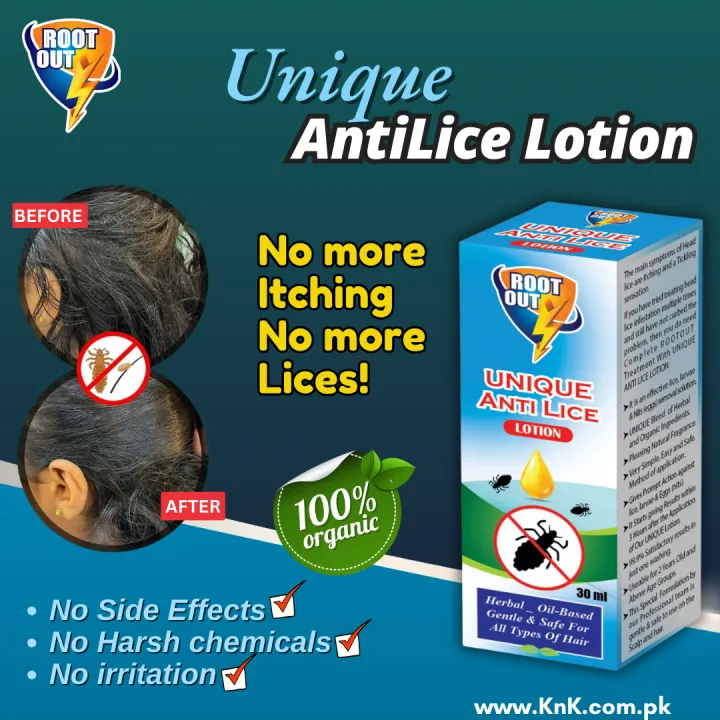 Anti%20Lice%20Lotion%20-%2030ml-%20Oil%20based%20For%20Hair%20&%20Skin%20-%20Natural%20HairOil-%20Hair%20Growth%20Oil%20Bottle%20-%20HairCare%20-%20Anti%20Lice%20Killing%20lotion%20-%20Hair%20Growth%20Serum%20-%20lotion%20For%20Long%20Hair%20-%20Lice%20Killer%20For%20Dandruff%20Remover%20,%20By%20Rootout%20-%20Image%203