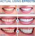 🦷 SP6 Probiotic Toothpaste – 6-Strain Oral Probiotics for Whitening, Enamel Repair & Fresh Breath | Fluoride-Free, Sensitivity Safe, Nano-Hydroxyapatite Formula for Daily Use | Natural Teeth Whitening Toothpaste for Men, Women & Kids – 100g. 