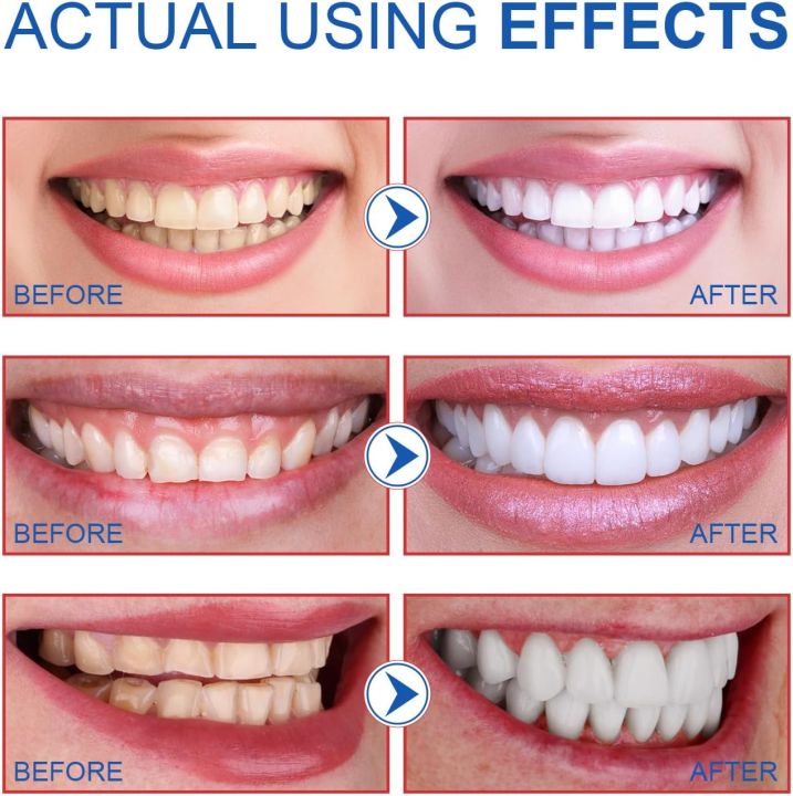 %F0%9F%A6%B7%20SP6%20Probiotic%20Toothpaste%20%E2%80%93%206-Strain%20Oral%20Probiotics%20for%20Whitening,%20Enamel%20Repair%20&%20Fresh%20Breath%20%7C%20Fluoride-Free,%20Sensitivity%20Safe,%20Nano-Hydroxyapatite%20Formula%20for%20Daily%20Use%20%7C%20Natural%20Teeth%20Whitening%20Toothpaste%20for%20Men,%20Women%20&%20Kids%20%E2%80%93%20100g%20-%20Image%204