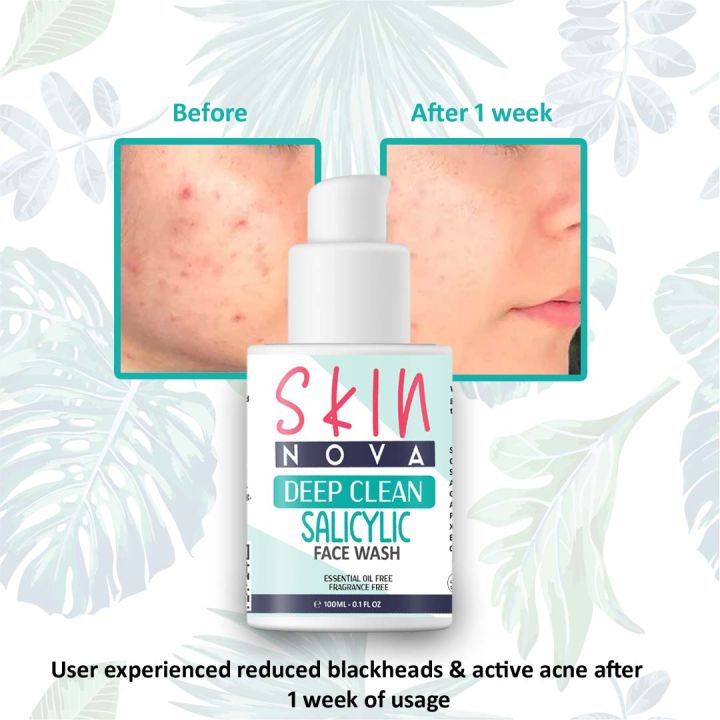 Skin%20Nova%20Deep%20Clean%20Salicylic%20Face%20Wash%20100%20ml%20-%20Image%203