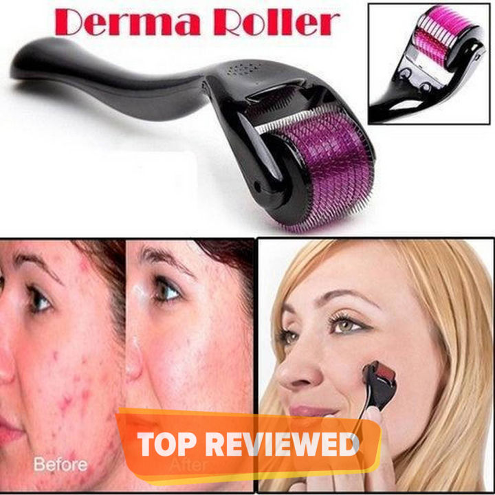 Derma Roller 1mm Skin Therapy Micro-Needle 540 For Acne Scars Wrinkles Stretch & Pores
