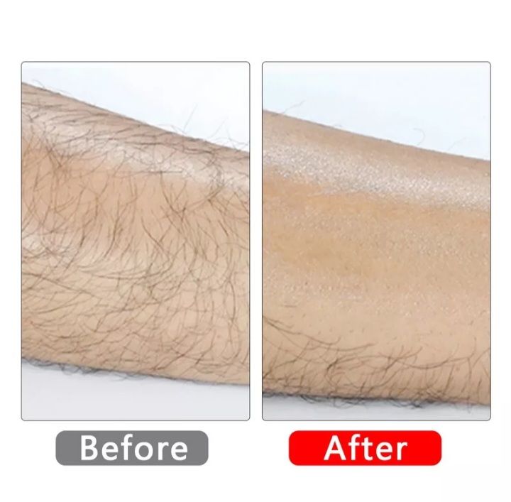 Crystal%20hair%20removal%20stone,%20Hair%20removal%20machine,%20Hair%20removal%20Epilator,%20Painless%20hair%20removal%20tool%20for%20men%20and%20women,%20Full%20body%20hair%20removal%20machine%20for%20women,%20Nano%20glass%20hair%20eraser%20-%20Image%203