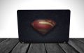 Superman Logo Laptop Skin for all Laptop models 11.6 12 13 14 15 15.6 All sizes High Quality Vinyl. 