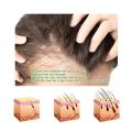 Derma Roller 0.5 Mm Hair & Skin System - High quality beauty dermaroller Micro pin derma roller 540 needle Derma Roller for hair regrowth facial roller kit. 
