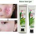 ALOE VERA ANTI-ACNE PIMPLE CREAM 30G. 