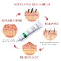 Bioaqua Salicylic Acid Acne Cream Reduces Redness Relieves Acne Scars Tightens Skin Softens Moisturizing Blackheads Removal Cream 20g bqy49044. 