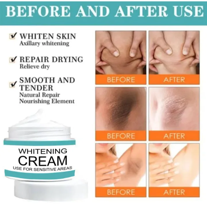 Whitening%20Emulsion%20Cream%20For%20Women%20Skin%20Lightening%20%7C%20Underarm%20Cream%20Dark%20Spot%20Cream%20For%20Underarm%20Neck%20Armpit%20Knees%20Elbows%20Intimate%20for%20girls%20and%20womens%20-%20Image%203