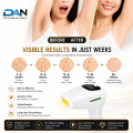 DAN TECHNOLOGY Professional IPL Hair Removal Device | Premium Permanent Hair Removal Machine | Smart Painless Laser Epilator for Face & Body. 